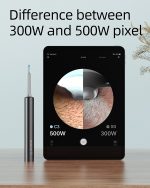 Bebird ERR1 Smart Wireless Ear Cleaner with HD Camera – White Box Mix Edition | Precision Ear Wax Removal Device - Image 2